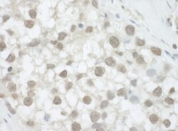 DHX36 Rabbit anti-Human, Mouse, Polyclonal, Bethyl Laboratories 100 &mu;l;