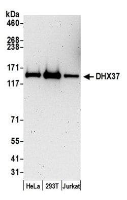 DHX37 Rabbit anti-Human, Polyclonal, Bethyl Laboratories 100 &mu;L; Unconjugated:Antibodies,