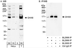 DHX8 Rabbit anti-Human, Polyclonal, Bethyl Laboratories 100 &mu;L; Unconjugated:Antibodies,