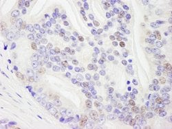 DHX9 Rabbit anti-Human, Polyclonal, Bethyl Laboratories 100 &mu;L; Unconjugated:Antibodies,