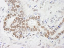 DHX9 Polyclonal Antibody, Bethyl Laboratories 10 &mu;L; Unconjugated:Antibodies,
