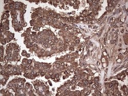DICER1 Monoclonal Antibody (OTI1G8), TrueMAB , OriGene 100 &mu;L; Unconjugated:Antibodies,