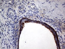 DIRAS2 Monoclonal Antibody (OTI8A5), TrueMAB , OriGene 100 &mu;L; Unconjugated:Antibodies,