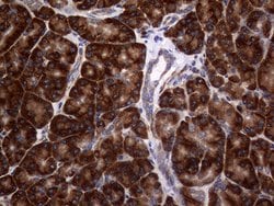 DIRAS2 Monoclonal Antibody (OTI8A5), TrueMAB , OriGene:Antibodies:Primary