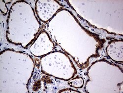 DIRAS2 Monoclonal Antibody (OTI8A5), TrueMAB , OriGene 100 &mu;L; Unconjugated:Antibodies,