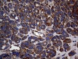 DIRAS2 Monoclonal Antibody (OTI8A5), TrueMAB , OriGene 100 &mu;L; Unconjugated:Antibodies,