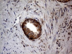 DIRAS2 Monoclonal Antibody (OTI8A5), TrueMAB , OriGene 100 &mu;L; Unconjugated:Antibodies,