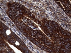 DIRAS2 Monoclonal Antibody (OTI8A5), TrueMAB , OriGene:Antibodies:Primary