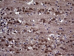 DIRAS2 Monoclonal Antibody (OTI10G5), TrueMAB , OriGene:Antibodies:Primary