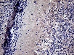 DIRAS2 Monoclonal Antibody (OTI10G5), TrueMAB , OriGene 30 &mu;L; Unconjugated:Antibodies,