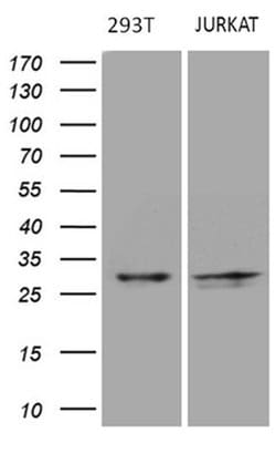 DIRAS2 Monoclonal Antibody (OTI8A5), TrueMAB , OriGene 100 &mu;L; Unconjugated:Antibodies,