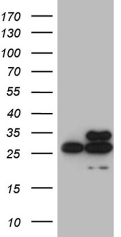 DIRAS2 Mouse anti-Human, Clone: OTI9G7, lyophilized, TrueMAB 100 &mu;g;