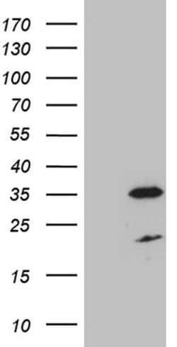 DIRAS2 Monoclonal Antibody (OTI10G5), TrueMAB , OriGene 30 &mu;L; Unconjugated:Antibodies,