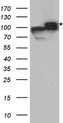 DISC1 Rabbit anti-Human, Mouse, Rat, Polyclonal, liquid, OriGene 100 &mu;L;