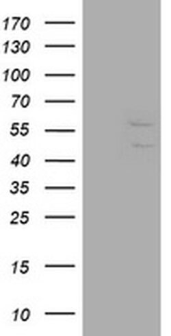 DIXDC1 Monoclonal Antibody (OTI6D4), TrueMAB , OriGene 100 &mu;L; Unconjugated:Antibodies,