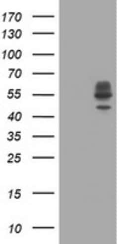 DIXDC1 Mouse anti-Human, Clone: OTI1A2, lyophilized, TrueMAB 100 &mu;g;