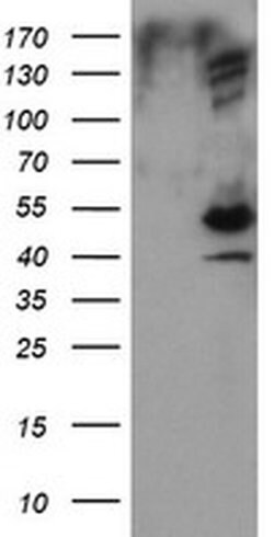 DIXDC1 Monoclonal Antibody (OTI1B3), TrueMAB , OriGene:Antibodies:Primary
