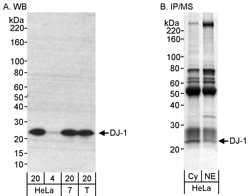 DJ-1 Rabbit anti-Human, Mouse, Polyclonal, Bethyl Laboratories 100 &mu;l;