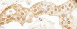 DJ-1 Polyclonal Antibody, Bethyl Laboratories 100 &mu;L; Unconjugated:Antibodies,