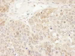 DJ-1 Polyclonal Antibody, Bethyl Laboratories 100 &mu;L; Unconjugated:Antibodies,