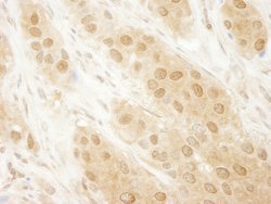 DJ-1 Polyclonal Antibody, Bethyl Laboratories 100 &mu;L; Unconjugated:Antibodies,