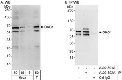 DKC1 Rabbit anti-Human, Polyclonal, Bethyl Laboratories 100 &mu;L; Unconjugated:Antibodies,