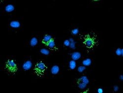 DLD Mouse anti-Human, Clone: OTI4E11, lyophilized, TrueMAB 100 &mu;g; Unconjugated:Antibodies,