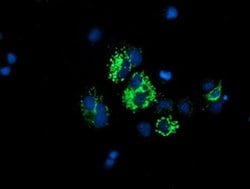 DLD Monoclonal Antibody (OTI4D5), TrueMAB , OriGene 100 &mu;L; Unconjugated:Antibodies,
