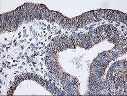 DLD Mouse anti-Human, Clone: OTI4E11, lyophilized, TrueMAB 100 &mu;g; Unconjugated:Antibodies,