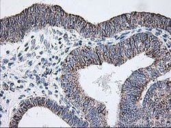 DLD Monoclonal Antibody (OTI4E11), TrueMAB , OriGene 30 &mu;L; Unconjugated:Antibodies,