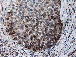 DLD Mouse anti-Human, Clone: OTI4E11, lyophilized, TrueMAB 100 &mu;g; Unconjugated:Antibodies,