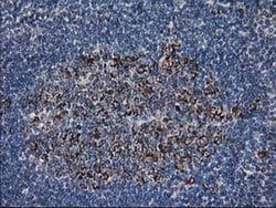 DLD Monoclonal Antibody (OTI4E11), TrueMAB , OriGene 30 &mu;L; Unconjugated:Antibodies,