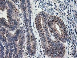 DLD Monoclonal Antibody (OTI4A10), TrueMAB , OriGene 30 &mu;L; Unconjugated:Antibodies,