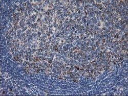 DLD Monoclonal Antibody (OTI4A10), TrueMAB , OriGene 30 &mu;L; Unconjugated:Antibodies,