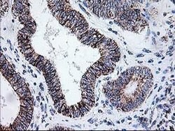 DLD Monoclonal Antibody (OTI4D5), TrueMAB , OriGene 100 &mu;L; Unconjugated:Antibodies,