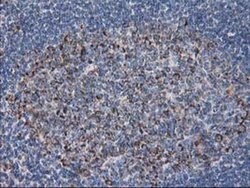 DLD Monoclonal Antibody (OTI4D5), TrueMAB , OriGene 100 &mu;L; Unconjugated:Antibodies,