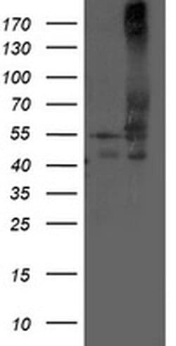DLD Monoclonal Antibody (OTI8A10), TrueMAB , OriGene:Antibodies:Primary