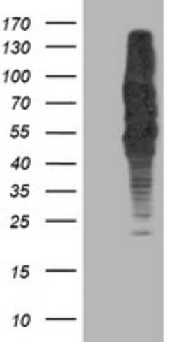 DLD Mouse anti-Human, Clone: OTI4E11, lyophilized, TrueMAB 100 &mu;g; Unconjugated:Antibodies,