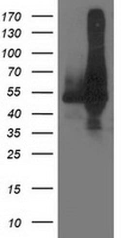 DLD Monoclonal Antibody (OTI6G6), TrueMAB , OriGene:Antibodies:Primary