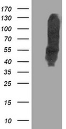 DLD Monoclonal Antibody (OTI4A10), TrueMAB , OriGene:Antibodies:Primary