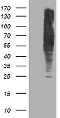 DLD Monoclonal Antibody (OTI4D5), TrueMAB , OriGene 100 &mu;L; Unconjugated:Antibodies,
