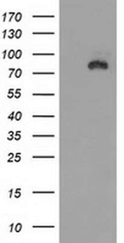 DLG3 Monoclonal Antibody (OTI3F2), TrueMAB , OriGene 100 &mu;L; Unconjugated:Antibodies,