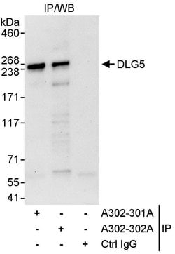 DLG5 Rabbit anti-Human, Polyclonal, Bethyl Laboratories 10 &mu;L; Unconjugated:Antibodies,
