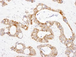 DLST Rabbit anti-Human, Mouse, Polyclonal, Bethyl Laboratories 100 &mu;L;