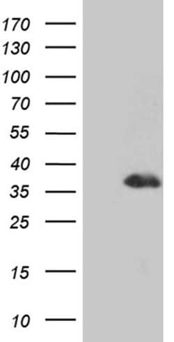 DLX1 Monoclonal Antibody (OTI3C5), TrueMAB , OriGene 100 &mu;L; Unconjugated:Antibodies,