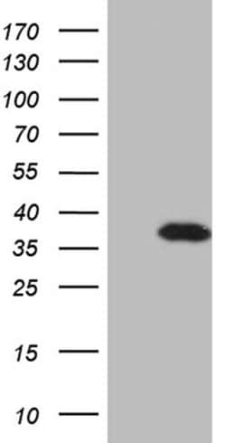 DLX1 Monoclonal Antibody (OTI1A2), TrueMAB , OriGene 30 &mu;L; Unconjugated:Antibodies,