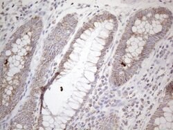 DLX4 Monoclonal Antibody (OTI8A1), TrueMAB , OriGene 100 &mu;L; Unconjugated:Antibodies,