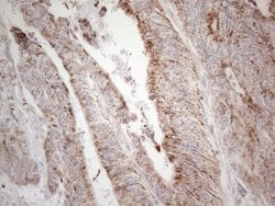 DLX4 Monoclonal Antibody (OTI8A1), TrueMAB , OriGene 100 &mu;L; Unconjugated:Antibodies,
