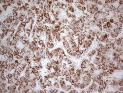 DLX4 Monoclonal Antibody (OTI8A1), TrueMAB , OriGene 100 &mu;L; Unconjugated:Antibodies,