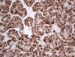 DLX4 Monoclonal Antibody (OTI7C8), TrueMAB , OriGene 100 &mu;L; Unconjugated:Antibodies,